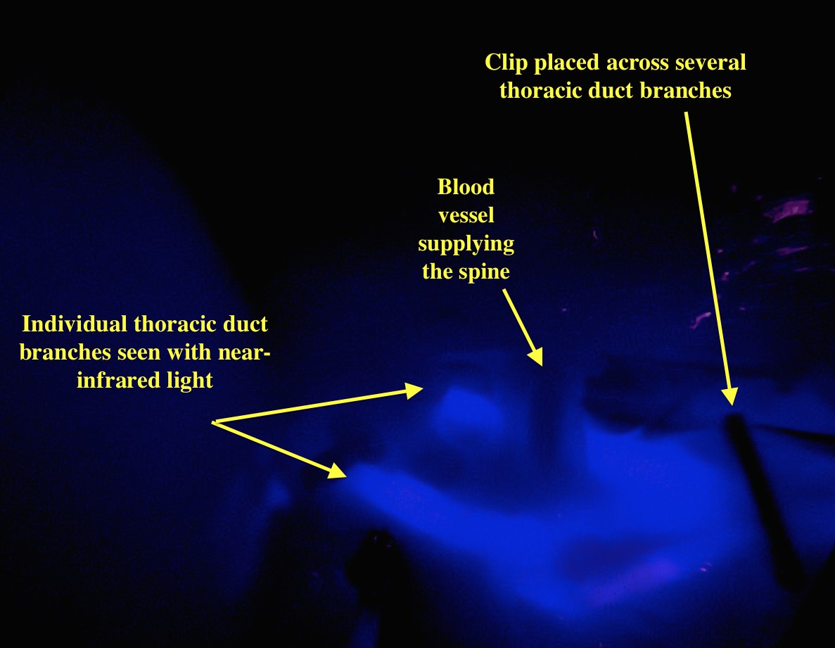 Near infrared imaging